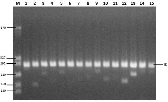 Şekil 4.23 te tüm genlerin M. tuberculosis H37Ra ATCC 25177 suşundaki PZR fotoğrafı 