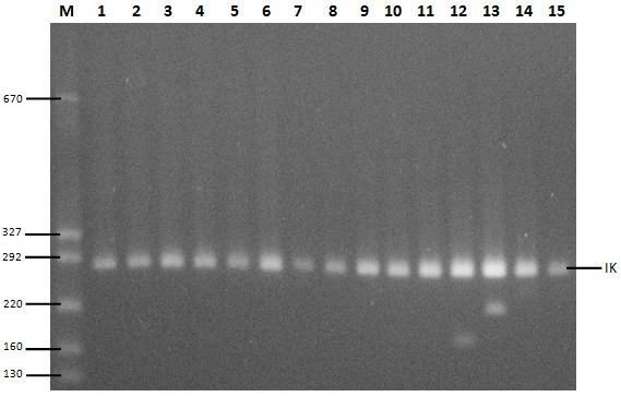 Şekil 4.24 te tüm genlerin M. tuberculosis H37Rv RSKK 598 Pasteur enstitüsü standart suşundaki PZR fotoğrafı görülmektedir. Şekil 4.24. Tüm genlerin M.