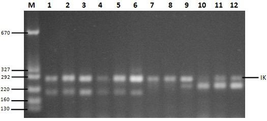 Sonuç olarak, 26 döngüdeki bant yoğunluklarından daha az yoğunlukta bantlar görmek istediğimiz için Rv1258c geni ile yapılacak olan multipleks PZR de döngü sayısının 25 olmasına, IK ve Rv1258c gen