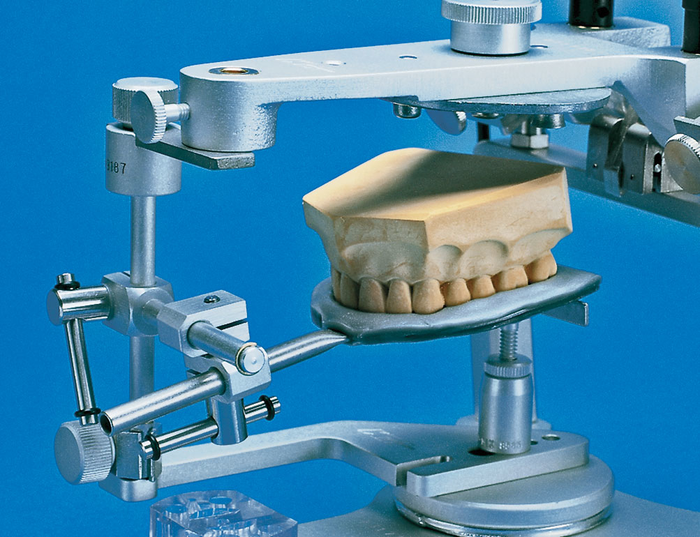 Ölçüden amaca uygun alçı kullanılarak doğru bir dental model elde edilir. 3.