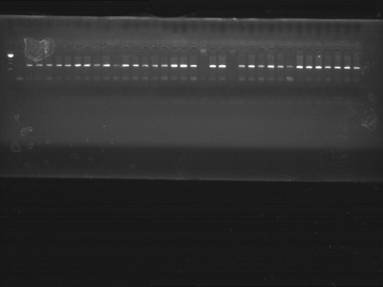 a b Şekil 6: IL 10-1082 ve 592 bölgesi PCR ürünü amplifikasyonun kontrol analizine ait jel görüntüsü A: PCR ürünlerinde amplifikasyonun olduğu ürünler B: PCR ürünlerinde amplifikasyonun olmadığı PCR
