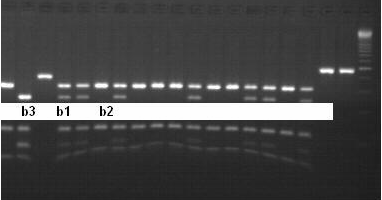 Şekil 8: IL-10 geni -592 bölgesinin enzim kesim analizine b2( -592CC), b1( -592CA), b3 (-592AA) genotiplerine ait jel görüntüsü 2.4.
