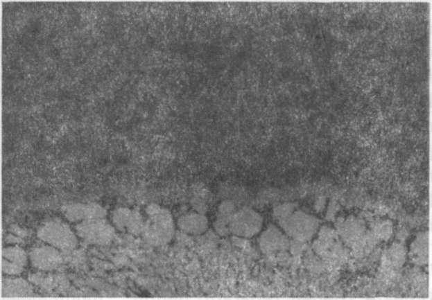 Enflamatuar reaksiyon ve reperatif dentin yapımı görülmemiştir (Resim 2-a, b). Resim 2b : Logocem (4. hafta) Aynı alanın büyük büyütmede görünümü (x 400, H.E.) Meron cam iyonomer siman grubundaki örneklerde genelde odontoblastik tabakanın normal görünümde olduğu, pulpa stroması ve subodontoblastik tabakada kapiller konjesyonun varlığı izlenmiştir.