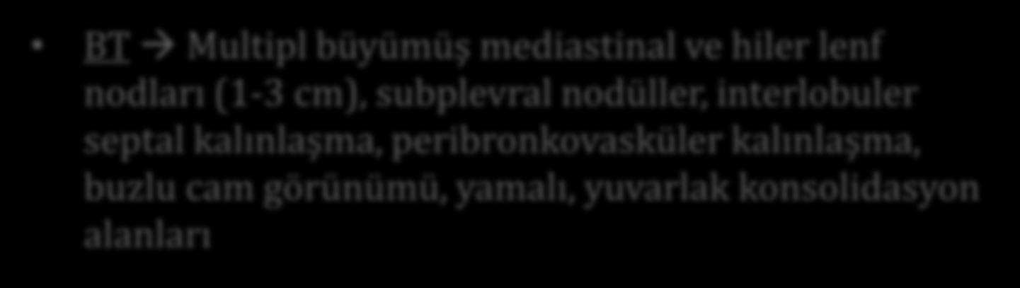 Görüntüleme PA İki taraflı retiküler ya da buzlu cam opasiteler, mediastende genişleme, bilateral plevral effüzyon BT Multipl büyümüş mediastinal ve hiler lenf nodları (1-3 cm), subplevral nodüller,