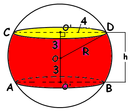 ) a)60 b)90 c)45 d)0 Yandaki şekilde küre merkezinden cm uzaklıkta bir düzlem ile hem üstten ve hem de alttan kesiliyor. Arakesit dairesinin yarıçapı 4 cm dir.