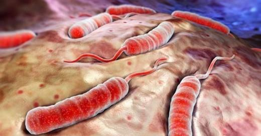 KOLERA Etkeni : Kolera, Vibrio cholerae isimli bakterinin neden