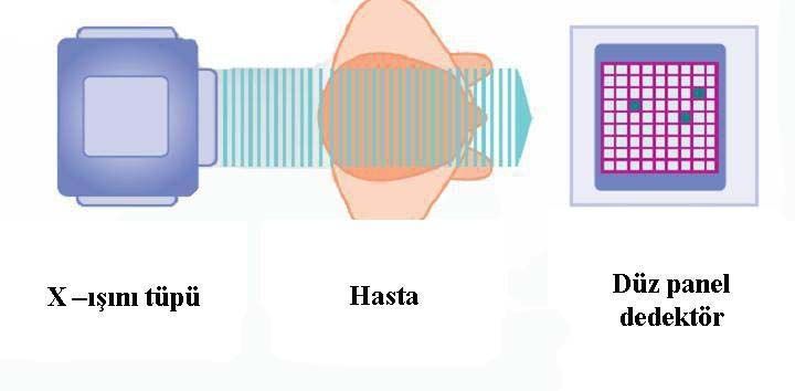Amorf silikondan yapılmış ince bir film transistorüne bağlı sezyum iyodür güçlendiriciden oluşan düz panel detektörlerin (FPD: flat panel detector) kullanımı ile, I.