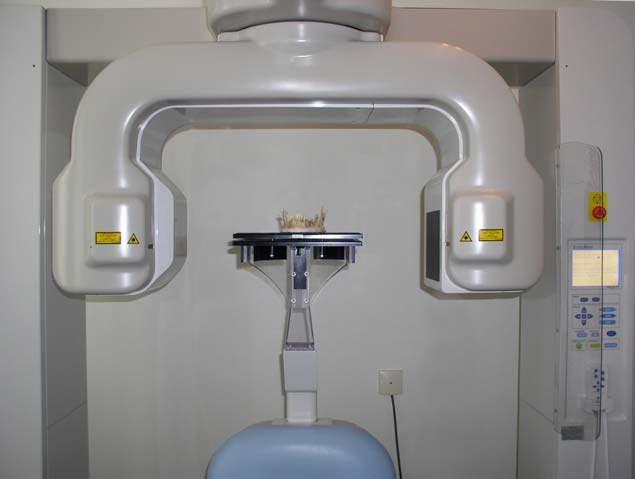 Konik ışın hüzmeli bilgisayarlı tomografi görüntüleri, Accu-I-Tomo (3DX) (Morita Co Ltd, Tokyo, Japan) cihazı ile 80 kv ve 1,5 ma ışınlama parametrelerinde elde edildi.