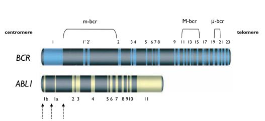 (Walz, C., and Sattler, M., 2006). ABL1 geninde kırık 5 ucunda 300 kb lık bölgede herhangi bir yerde gerçekleģebilir. Bu kırık genelde alternatif 1.