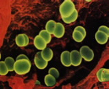 Bacteroides vulgatus ve Bacteroides stercoris fazla olduğu kişilerde kolon kanseri riski