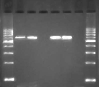 Tikveşli S, Cevahir N, Kaleli İ. M 1 2 3 4 5 6 M 585 bp Resim 1. PCR ile CTX-M genlerinin agaroz jeldeki görüntüsü.