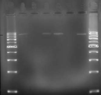 PCR ile CTX-M grup 1 genlerinin agaroz jeldeki görüntüsü.