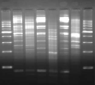 Klebsiella pneumoniae Klinik İzolatlarında CTX-M Tipi Beta-Laktamazların Fenotipik ve Moleküler Yöntemlerle Araştırılması M 1 2 3 4 5 6 M Resim 3. RAPD-PCR sonuçlarının agaroz jeldeki görüntüsü.