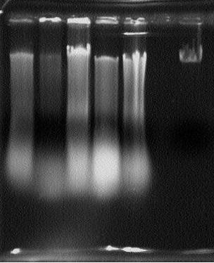 1 2 3 4 5 M Şekil 1. Estre edilen DNA örnekleri M: Marker 1. 2,4-D ile elde edilmiş kallus 2. Kinetin ile elde edilmiş fide 3. BAP ile elde edilmiş fide 4. Tabii ortamda yetişmiş bitki 5.