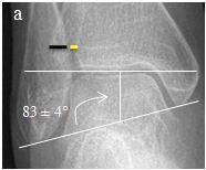 Anteroposterior, lateral ve mortis görüntüleri ise ayak bileğinin standart üç yönlü radyografi serisini oluşturur (5) (Şekil 2.14).