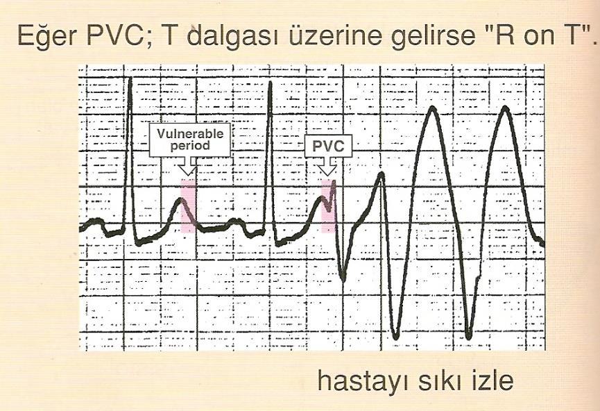 7 Şekil 11. R on T fenemoni 1.4.