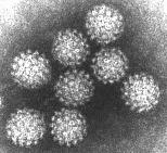 (42) Resim 4. HPV partikülünün elektron mikroskobu görüntüsü 2.7.5.2. Đmmunoflorasan Yöntem: Biyopsi örneklerinde HPV nin major kapsid proteininde (L1) bulunan epitoplara karşı oluşmuş olan poliklonal antikorlar kullanılır.