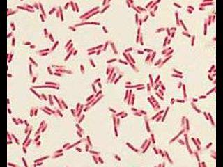BAKTERİLERİN SINIFLANDIRILMASI I-MORFOLOJİK ÖZELLİKLERİNE GÖRE a-boyanma özelliklerine göre(gram Boyama) A-Gram(+) bakteriler : Mikroskopta mor