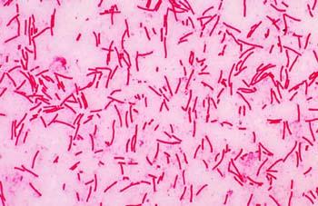 oluşturanlar Aerob Anaerob Bacillus Clostridium C-Gram (+)