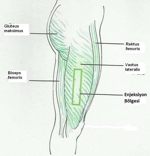 çizilir. Lateral femoral kondilin üzerindeki yatay çizginin sınırları, bacağın o bölümündeki enine göre belirlenir.