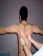 testi :Kollar nötralde skapula alt açısı-torakal vertebra spinöz çıkıntı arası mesafe: Tarih: Sağ: Sol: