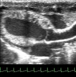 ventrikülün parasternal uzun eksen görüntüsü) Dokserkalsifer ol (0,167 µg/kg) ile tedavi edilen 10 sıçandan 9 unda oluşan, işaretli kardiyak/aorti k kalsifikasyon* Noonan