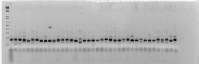 Bu SSR lardan gwm 614, 2B kromozomunu ve gwm 469 ise 6D kromozomunda bulunmamaktadır (Çizelge 4.9).
