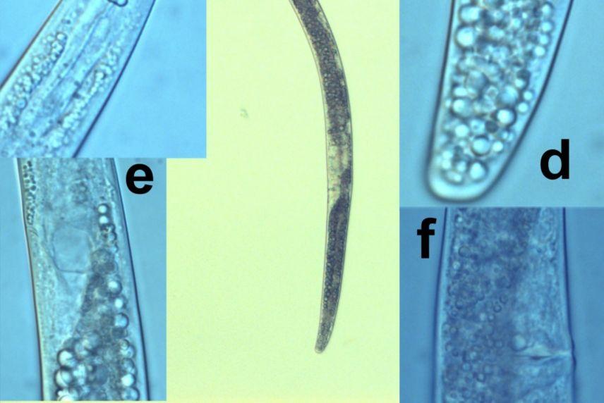 altındaki görüntüsü (a:genel görünüm, b: Spermatheca,
