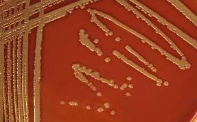 82 Resim 3.3. Koyun Kanlı Agar da Staphylococcus kolonilerinin görünümü (Suş No.