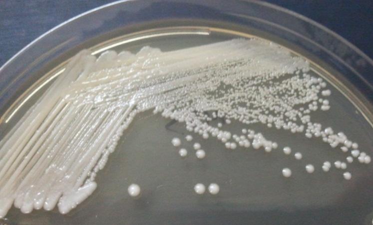 inkübasyona bırakılmıştır Sabouraud Dextrose Agar (Oxoid CM0041) da krem rengi, beyaz, yuvarlak, düzgün kenarlı koloniler, Candida olarak