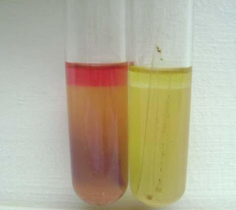 106 Ferric ammonium citrate 0,5 Brom cresol purple 0,02 Agar 2,0 Hazırlanışı: Besiyerinden 36,5 g. tartılıp 1 litre distile su içinde çözdürülür.