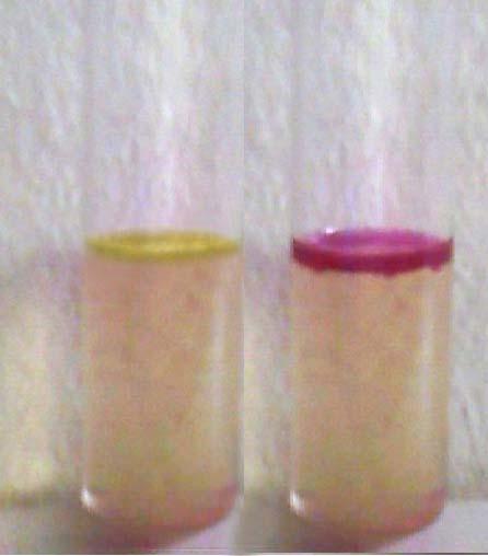 108 3.18.7.İndol testi Bu test, mikroorganizmaların triptofan aminoasidini ayrıştırarak indol oluşturma yeteneğini belirlemek için kullanılır.