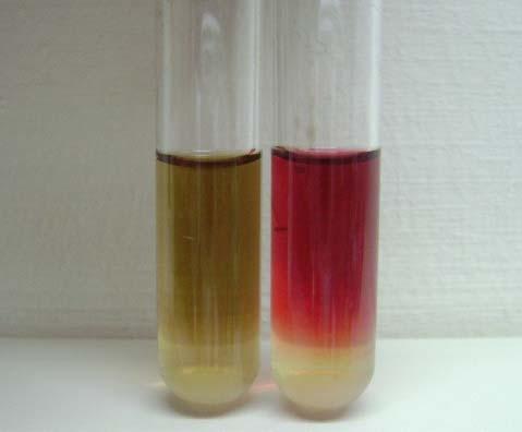 117 Resim 3.18. Voges proskauer testi (A) Negatif reaksiyon (B) Pozitif reaksiyon 3.18.18 Malonat kullanımı testi Bu test, mikroorganizmaların besi yerlerine konan malonat'tan karbon kaynağı olarak yararlanabilme yeteneğini ölçmede kullanılır.