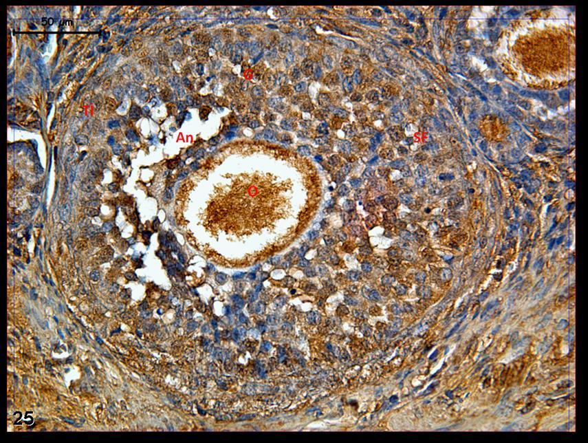 Resim 25: Hormon uygulaması yapılan gruplara ait gebe ovaryum dokusunda c-fos boyamasında, sekonder folllikülde oosit ve granuloza hücrelerinde belirgin tutulum izleniyor.
