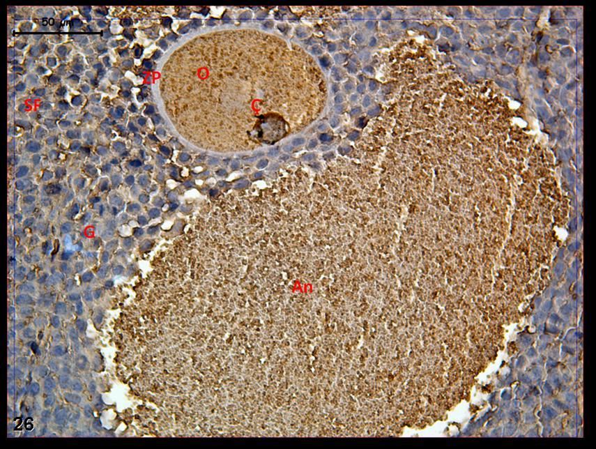 Resim 26: Hormon uygulaması yapılan gruplara ait gebe ovaryum dokusunda daha büyük büyültmelerde, çekirdek ve oosit düzeyinde belirgin c-fos tutulumu