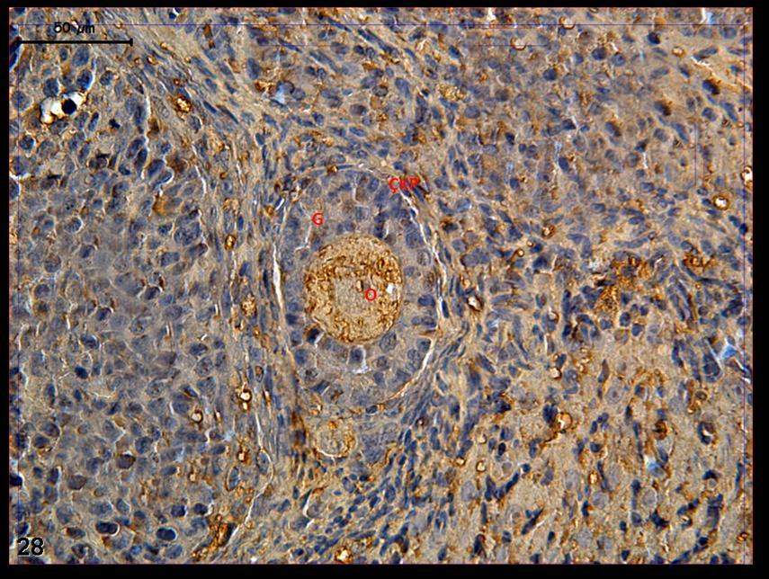 Resim 28: Klomifen sitrat uygulaması yapılan gruba ait kontrol grubu ovaryum dokusunda yapılan c-fos boyamasında tutulumun çekirdek ve sitoplazma düzeyinde