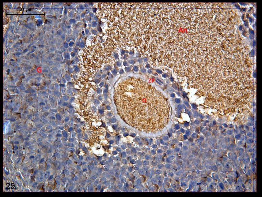 Resim 29: Klomifen sitrat uygulaması yapılan gruba ait kontrol grubu ovaryum dokusundaki c-fos immünreaktivitesi daha büyük büyültmelerde incelendiğinde tutulumun oositte