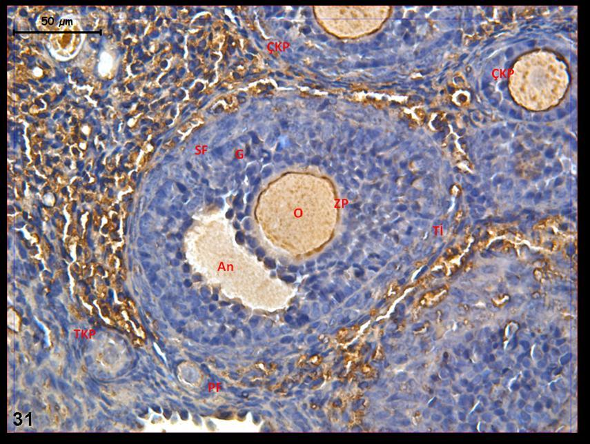 Resim 31: Klomifen sitrat uygulaması yapılan grup ovaryum dokusunda yapılan c-fos boyamasında granuloza hücrelerinde tutulumun az yoğun olduğu görülüyor.