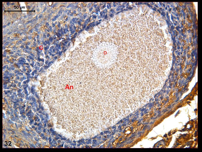 Resim 32: : Klomifen sitrat uygulaması yapılan grup ovaryum dokusunda yapılan c-fos boyamasında tutulumun hormon uygulaması