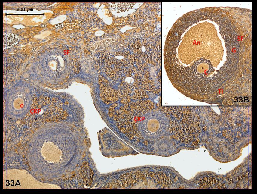 Resim 33A,B: Klomifen sitrat uygulaması yapılan gruba ait gebe ovaryum dokusunda, doku genelinde folliküllerde c-fos tutulumunun belirgin olarak arttığı ve granüloza hücrelerinde, oosit ile teka