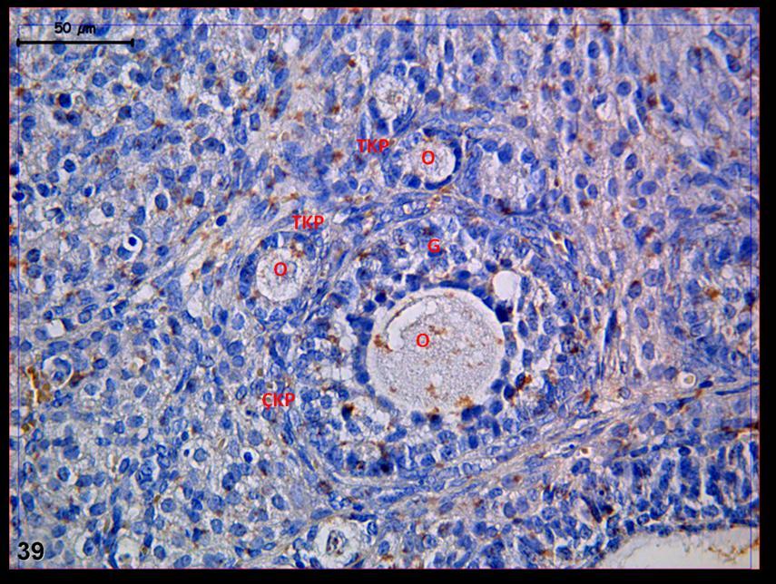 Resim 39: : Hormon uygulaması yapılan gruba ait ovaryum dokusunda yapılan LIF boyamasında; tek ve çok sıralı primer foliküllerde tutulumun zayıf-orta dereceli