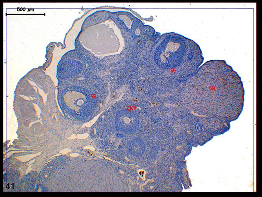 Resim 41: Hormon uygulaması yapılan gruba ait gebe grubu ovaryum dokusunda yapılan LIF boyamasında, doku genelinde bazı folliküllerde diğer gruplara karşın