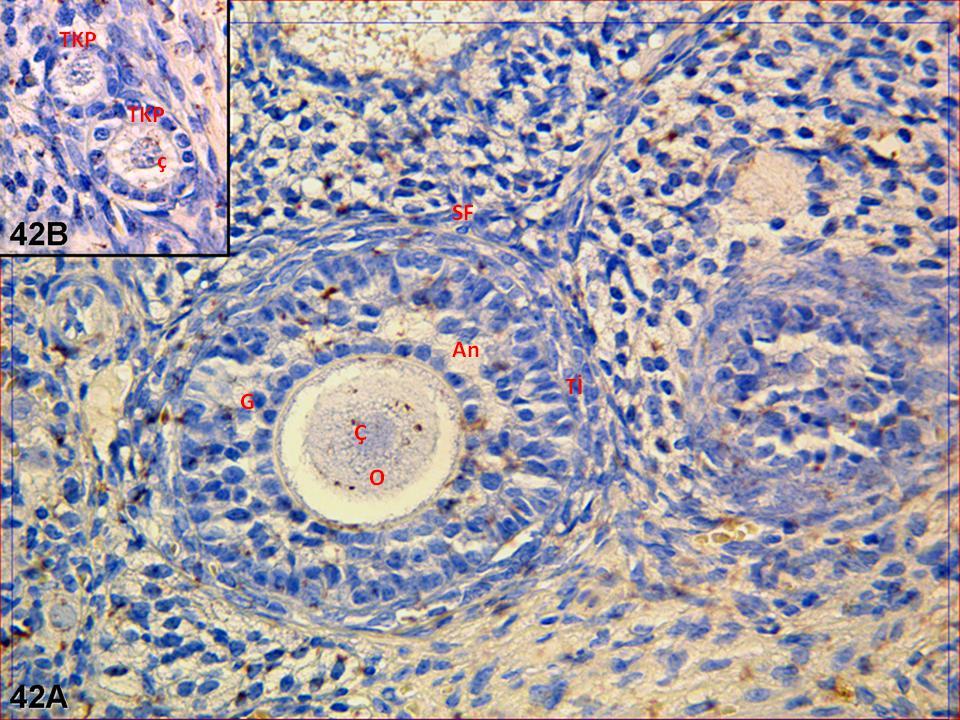 Resim 42A,B: Hormon uygulaması yapılan gruba ait gebe ovaryum dokusunda yapılan LIF boyamasında; tek ve çok sıralı primer foliküllerde bir önceki gruba karşın tutulumun biraz daha arttığı