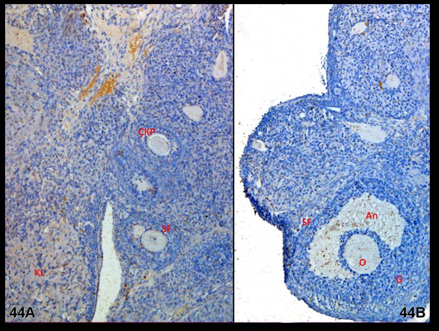 Resim 44A,B: Klomifen sitrat uygulaması yapılan gruba ait kontrol ovaryum dokusunda yapılan LIF boyamasında tutulumun hormon uygulaması yapılan grubun kontrol grubuyla eşdeş olduğu