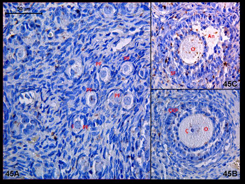 Resim 45A,B,C: Klomifen sitrat uygulaması yapılan gruba ait kontrol ovaryum dokusunda; primordiyal, çok sıralı primer ve sekonder foliküllerde LIF immünreaktivitesinin son derece zayıf olduğu