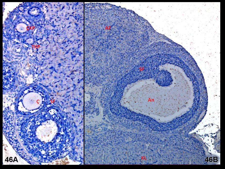 Resim 46A,B: Klomifen sitrat uygulaması yapılan gruplara ait ovaryum dokusunda, LIF immünreaktivitesinin korpus luteum hücrelerinde biraz daha çok olduğu dikkati çekiyor.