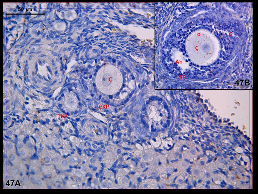 Resim 47A,B: Klomifen sitrat uygulaması yapılan gruplara ait ovaryum dokusunda yapılan LIF boyamasında, sekonder folliküllerde oositi çevreleyen ilk sıra hücrelerde tutulumun biraz daha arttığı