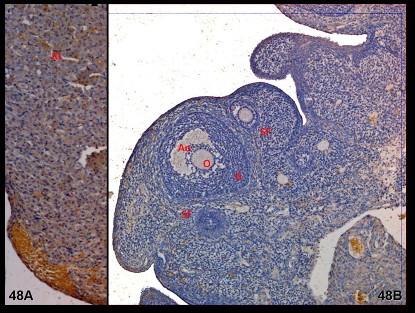 Resim 48A,B: Klomifen sitrat uygulaması yapılan gruba ait gebe ovaryum dokusunda LIF immünreaktivitesinin diğer gruplara karşın artmış olması ilgiyi