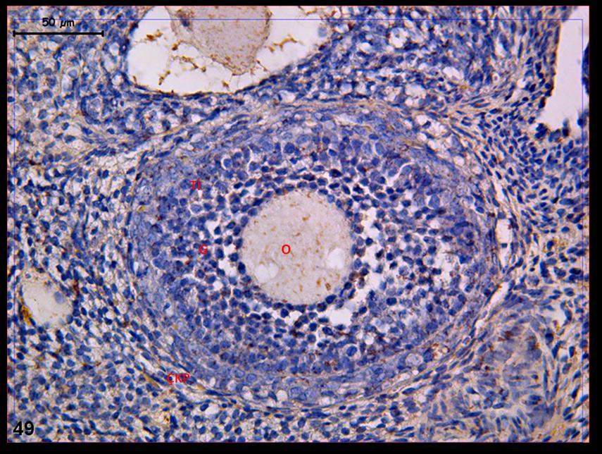 Resim 49: : Klomifen sitrat uygulaması yapılan gruba ait gebe ovaryum dokusunda LIF tutulumunun oosit sitoplazmasında az yoğun olduğu izleniyor.