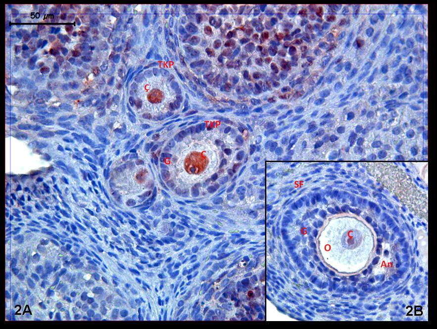 Resim 2A,B: Hormon uygulaması yapılan gruplara ait kontrol ovaryum dokusunda; gelişen foliküllerde oosit çekirdeği düzeyinde kuvvetli olmakla birlikte, sekonder folikülden itibaren azalan PCNA